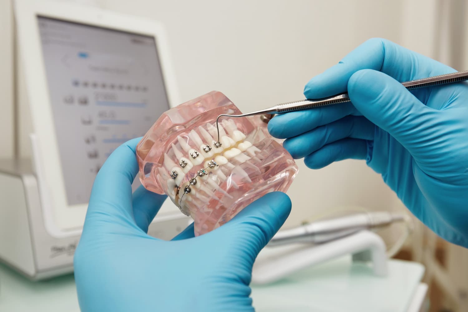 teeth straightening options