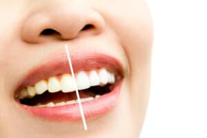 Cosmetic dentist woodland hills