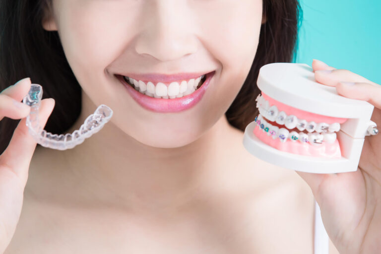 Teeth Straightening in Woodland Hills