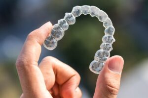 Invisalign in woodland hills