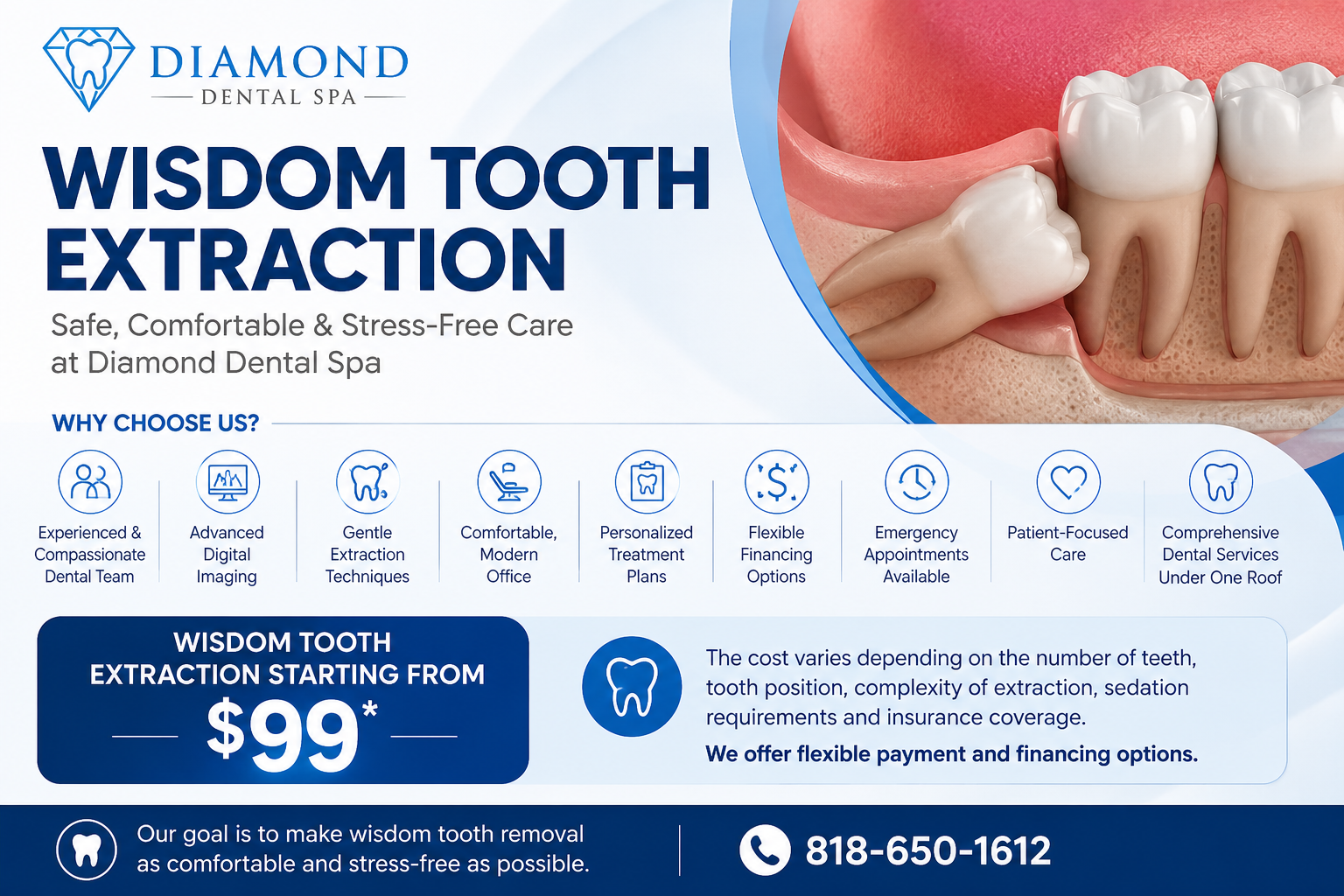 wisdom tooth extraction woodland hills 