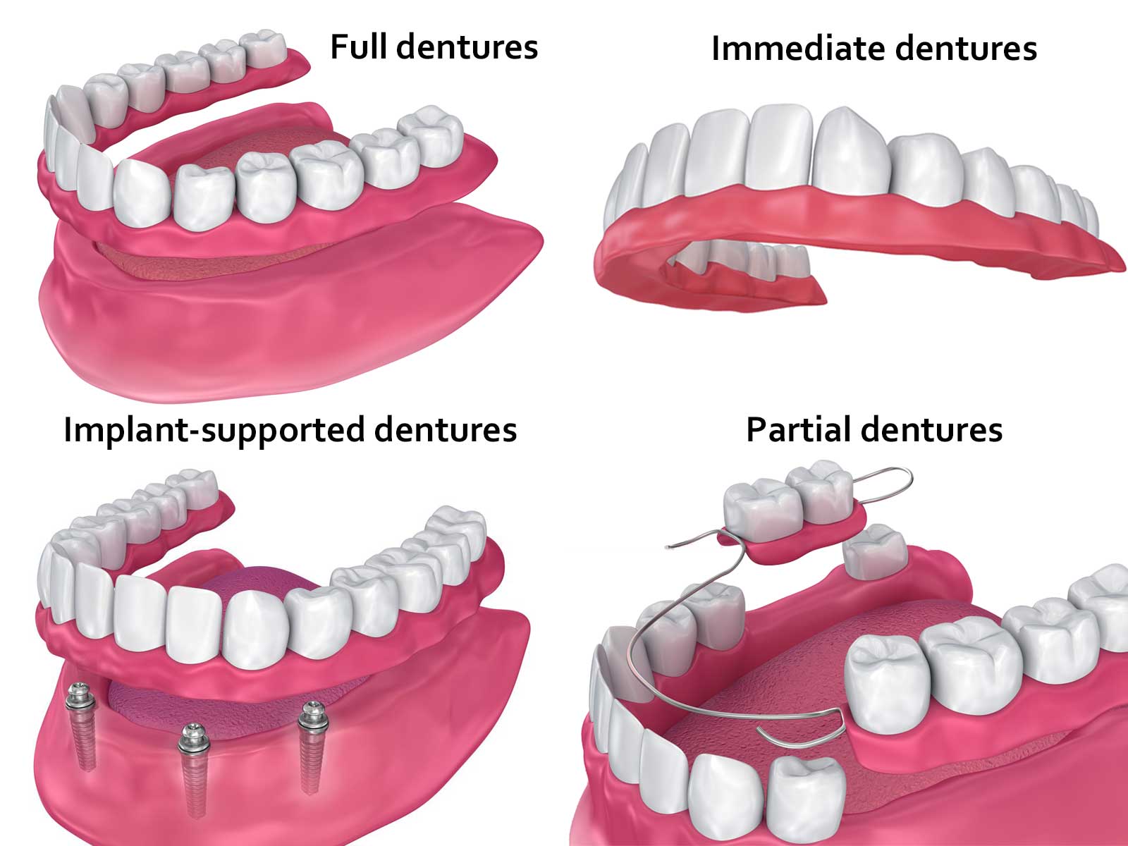 dentures in calabasas
