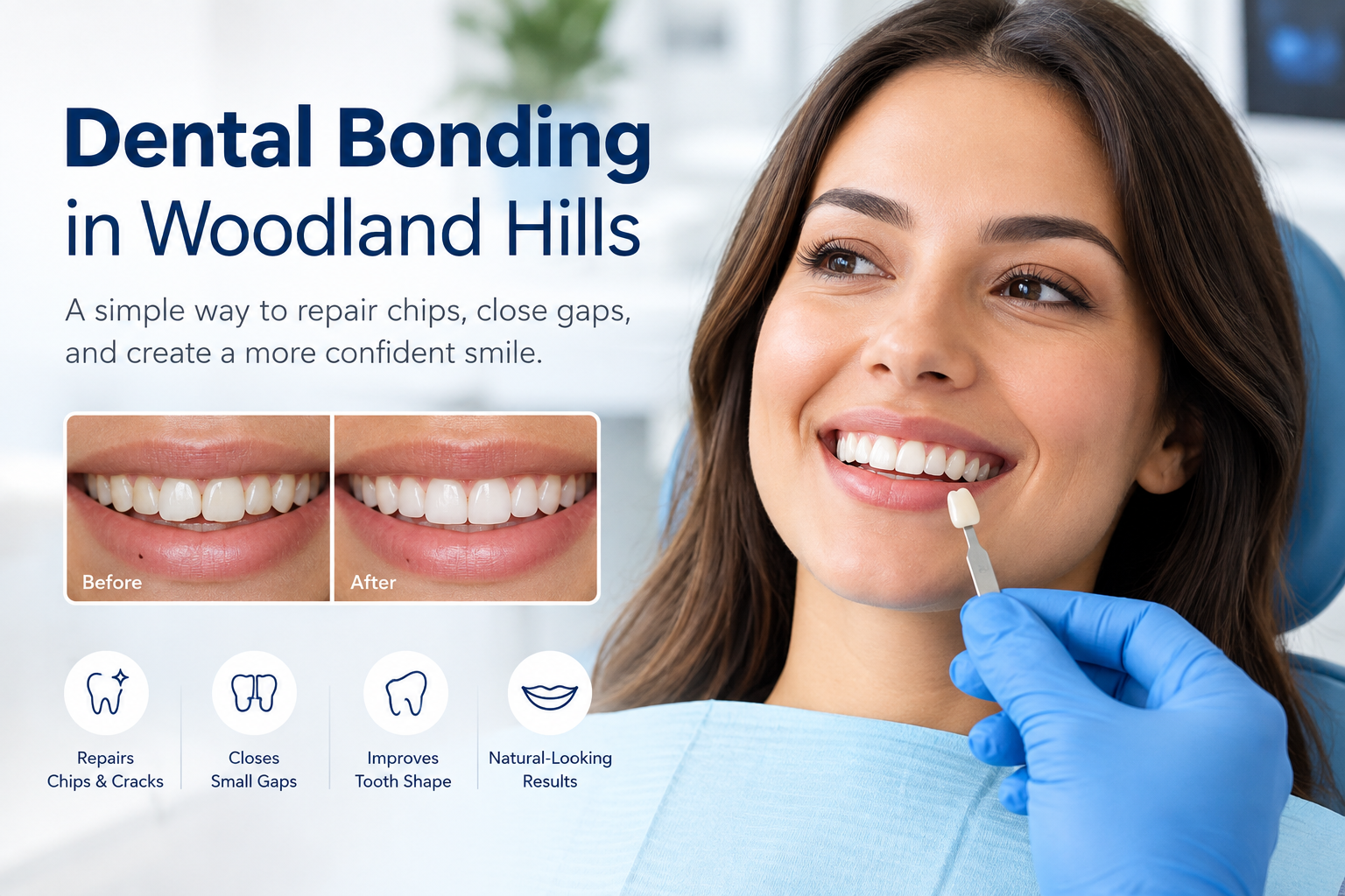 dental bonding woodland hills